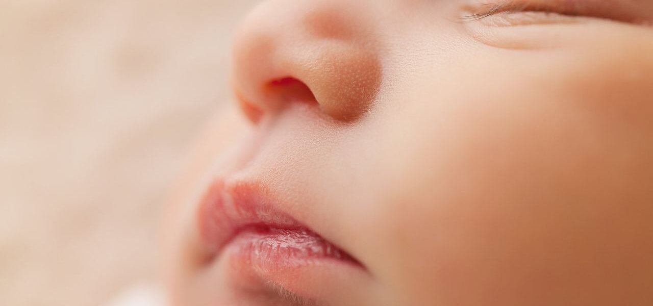 babyacne oorzaak en behandeling